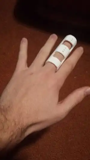 3D Printed Finger Splint