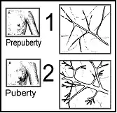 types 1 & 2 lobules