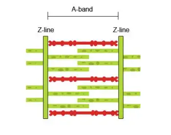 (Over)Contracted myofibril