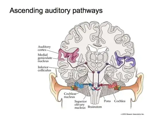 AuditorySystem