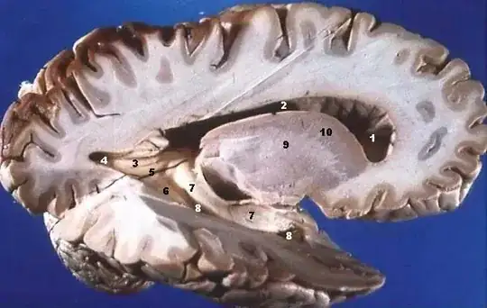 neocortex (source: Wikipedia)