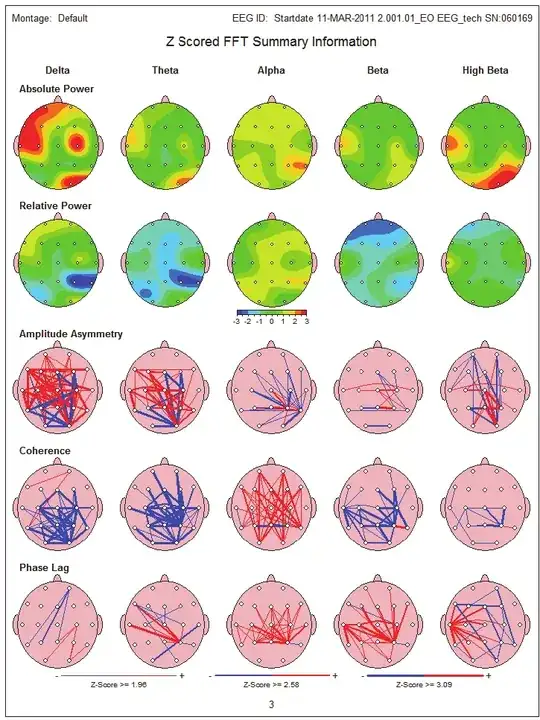 sample qEEG map