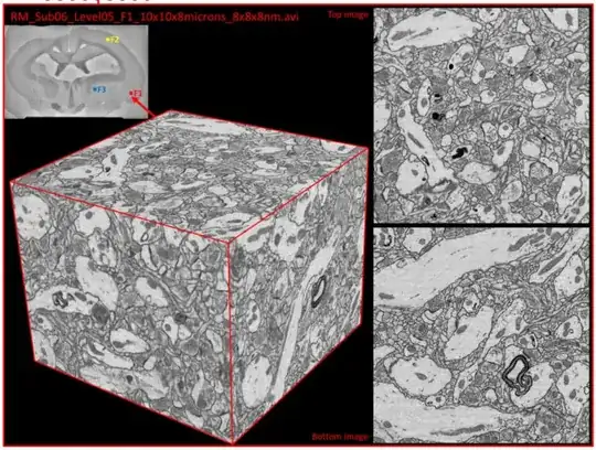 scanning of preserved intact mammalian brain