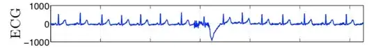 ECG from a research Paper