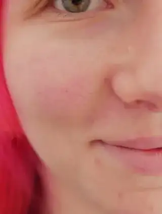 Woman's face crop with exaggerated skin colour differences