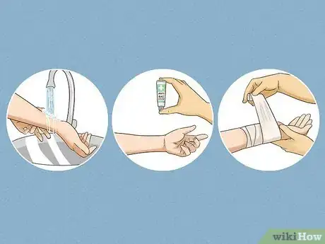 Image titled Remove Cactus Needles Step 4